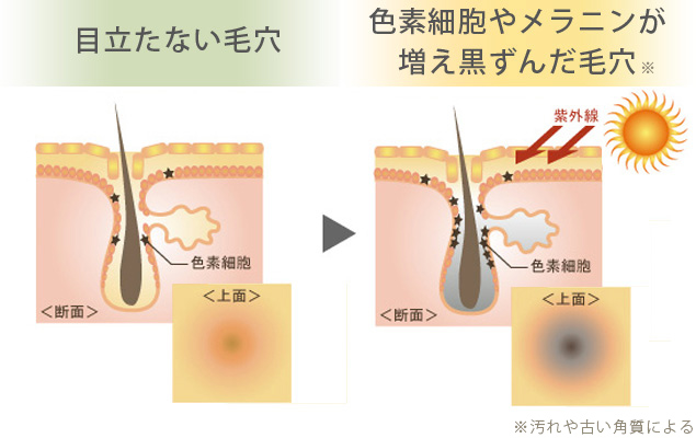 毛穴のお悩み】 毛穴エイジングとは？｜アンサージュ