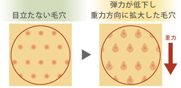 毛穴のお悩み 毛穴エイジングとは アンサージュ